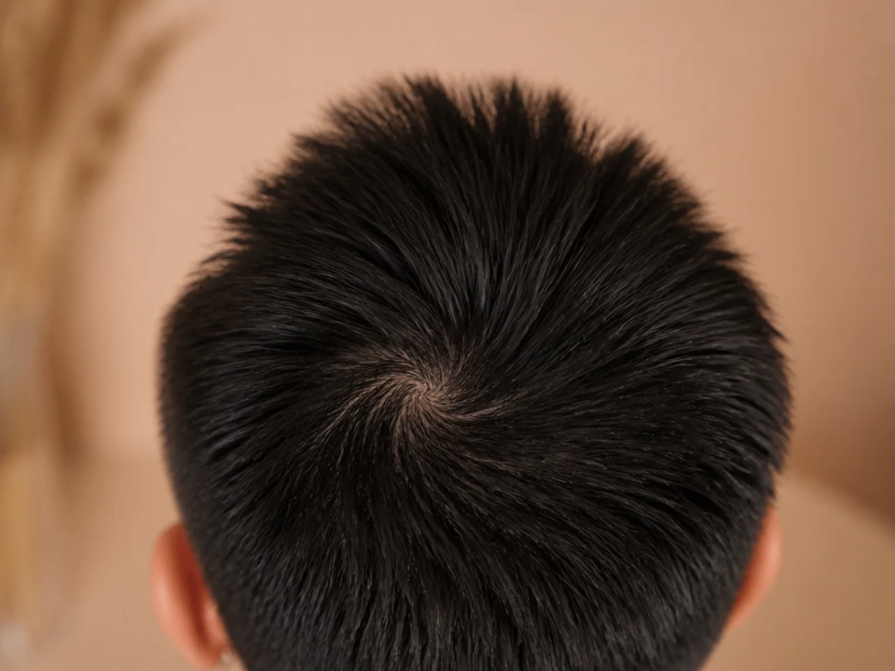 The crown of a head showing a hair whorl with short hair standing upright